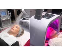 One Session of BioRePeel Facial Chemical Peel