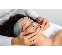 One Session of Dermaplaning and Chemical Peel targeting Pigmentation