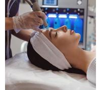 One session of Microneedling with Hyaluronic acid using a dermapen ( Best for a top up or trial)