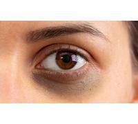 One session of Vitaran/Jalupro skin Tightening Treatment
