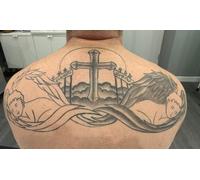 One small area up to 3cm x 3cm: one session of tattoo removal