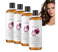 Onion Hydrosol Conditioner with Biotin & Rosemary, Routine Shampoo and Conditioner for Women Hair Loss, Thicker and Longer Hair, Soothes the Scalp, Biotin & Cinnamon Extract for Stronger (4pcs)