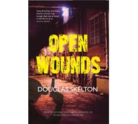 Open Wounds