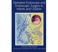 Operative Endoscopy and Endoscopic Surgery in Infants and Children