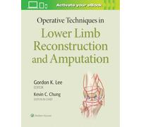 Operative Techniques in Lower Limb Reconstruction and Amputation: Lower Limb Surgery