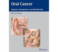 Oral Cancer: Diagnosis, Management, and Rehabilitation