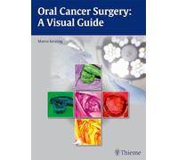Oral Cancer Surgery: A Visual Guide