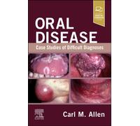 Oral Disease: Case Studies of Difficult Diagnoses: Case Studies of Difficult Diagnoses