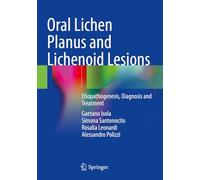 Oral Lichen Planus and Lichenoid Lesions: Etiopathogenesis, Diagnosis and Treatment