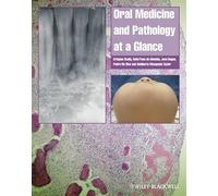 Oral Medicine and Pathology at a Glance (At a Glance (Dentistry))