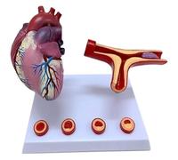 Organ Model Artery and Blood Vessel Blockage Thrombosis Model, Human Heart Model, Heart Coronary Artery Bypass Model, for Classroom and Cardiology Study Anatomy Model.