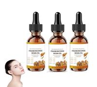 Organic Frankincense Resin Oil, Reduces Fine Lines & Wrinkles, Soothes & Repairs Facial Skin, Deep Hydration for Face and Body, Natural Anti-Aging Serum for Women & Men 60ml (3)