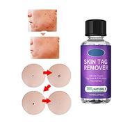 Organic SkinTag Solution,Organic Skin Tag Solutions Serum,Tags & Moles Remover,Mole and Skintag Remover Serum Solution,Skin Tag Removal Solution, Skin Tag Repair Solution (10ML-1PC)