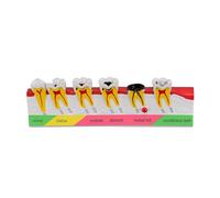 Orivin Dental Caries Developing Model,Teeth Model for Dental Tooth Anatomy Study, Doctor-Patient and Oral Care Education