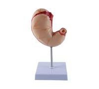 Orivin Human Natural Stomach Anatomical Model Plastic Disassemblable for Studying Gastric Structure and Texture Size 12X12X21cm