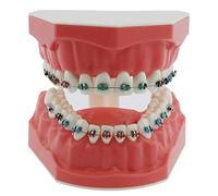 Orthodontic Model Dental Models 1:1 Standard Typodont Teeth Model M7010-2 Demo Teach Study with Archwire Ligature Ties Metal Brackets Buccal Tubes