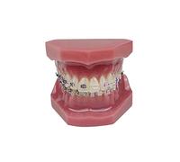 Orthodontic Model, YOUYA DENTAL 1/4 Metal self-Locking Comparison Orthodontic Model Orthodontic Tooth Model Dental Teaching Teeth Model with Metal Braces Bracket for Dentist Teaching Tools to Display