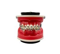 Orthodontic Teaching Model, YOUYA DENTAL Orthodontics Malocclusion Teeth Typodont Demonstration Educational Training Model Red Wax Gum Teeth Practice Model for Teaching Study (Orthodontic Model)