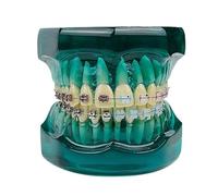 Orthodontic Teeth Model With Self Ligating Metal Ceramic Braces Bracket For Patient Communication Dental Treatment Demo Model