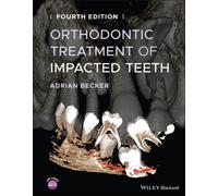 Orthodontic Treatment of Impacted Teeth