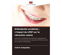 Orthodontie accélérée : L'impact du LPRF sur la rétraction canine: Amélioration de l'efficacité de la rétraction canine grâce à la fibrine riche en ... dans le cadre d'un traitement orthodontique