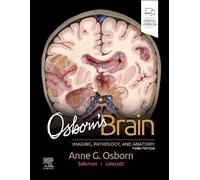 Osborn's Brain, Osborn, Anne G., Hardback