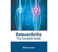 Osteoarthritis: The Complete Guide