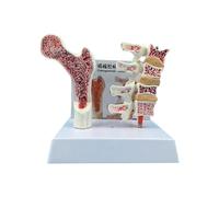 Osteoporosia Spine Model Human Anatomy Osteoporosia Model Medicals Learning Tool for Anatomy Education Constructed Spine Medicals Learning Tool Human