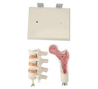 Osteoporosis Spine Model Demonstrating Pathological Changes Visualized in Vertebral Tissues for Clinical Teaching in Doctor Offices