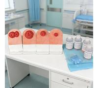 Ostomy Care Training Kit, 4pcs Realistic Simulator for Medical Education and Skills Training, Practical Wound Care Models for Ostomy Practice