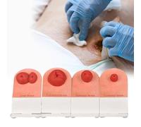 Ostomy Care Training Kit - 4pcs Stoma Models for Medical Education, Tabletop Simulation, Wound Care Practice, First-aid Course Teaching Demonstration