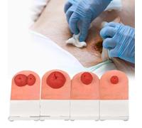 Ostomy Care Training Kit, 4pcs Tabletop Simulation Fecal Ostomy Practice Model, Stoma Models for Medical Education, Wound Care Models, for First-aid Course