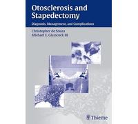 Otosclerosis and Stapedectomy: Diagnosis, Management and Complications