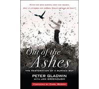 Out of Ashes: The Restoration of a Burned Boy