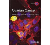 Ovarian Cancer (State of the Art)