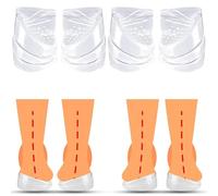 Overpronation Insoles, 2 Pairs Pronation Orthotic Insoles, 3 Layers Adjustable Heel Wedge Orthopedic Insoles, Medial Heel Wedge for Pronation & Upward Rotation for Women Men Xo Leg (L)