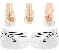 Overpronation Insoles for Women Men Posture Corrector Orthotic Insoles, 3 Layers Adjustable Heel Wedge Corrective Inserts Correction for Supination & Pronation