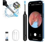 Oxbird Ear Wax Removal Kit Tool with Camera, 1080P Wireless Earwax Camera Ear Camera Otoscope Cleaner Smart Ear Cleaner with Camera and Light for iPhone, Ipad & Android Smart Phones (Black)