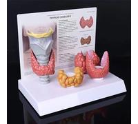 P9IDEDFH Thyroid Nodule Model, for Science Classroom Study Display, Human Medical Teaching Medical Model, Thyroid Nodule, Papillary Cancer, Thyroiditis, Goiter, Thyroid Case Model