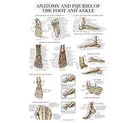 Palace Learning Laminated Anatomy and Injuries of the Foot and Ankle Poster - Anatomical Chart of Foot and Ankle Joint - 18" x 24"