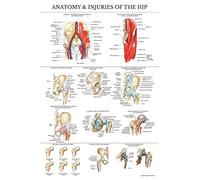 Palace Learning Laminated Anatomy and Injuries of the Hip Poster - Hip Joint Anatomical Chart - 18" x 24"