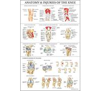 Palace Learning Laminated Anatomy and Injuries of the Knee Poster - Knee Joint Anatomical Chart - 18" x 24"