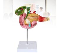 Pancreatic Duodenal Gallbladder Pathological Model, Liver Anatomical Model for Teaching and Demonstrating Anatomical Models