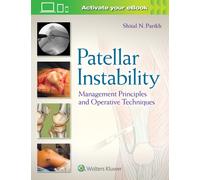 Patellar Instability : Management Principles and Operative Techniques