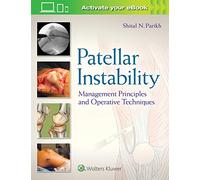 Patellar Instability: Management Principles and Operative Techniques