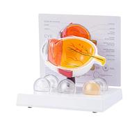 Pathological Anatomy Model Human Anatomical Eye Teaching Tool for Clinical Setting Educational Use Glaucoma Eye