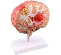 Pathological Brain Structure Anatomy Model - Life Size Human Brain Model - Educational Model Brain Anatomical Model - PVC Cerebral Cortex Gray Matter Nerve Model - for Teaching Ed