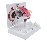 Pathological Eye Model - Human Eye with Cataracts and Cornea for Teaching - Anatomical Eyeball Demonstration Model for Educational Purposes
