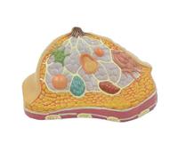 Pathological Human Organ Anatomy Model Female Breast Cut face Model Colorful Teaching Model as Teaching Tool (A )