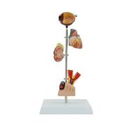 Pathological Kidney Anatomy Model for Diseases Study, Human Pathology Demonstration Medical Teaching Heart Structure